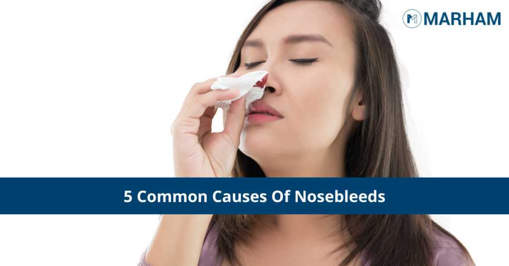 5 Common Causes Of Nosebleeds 