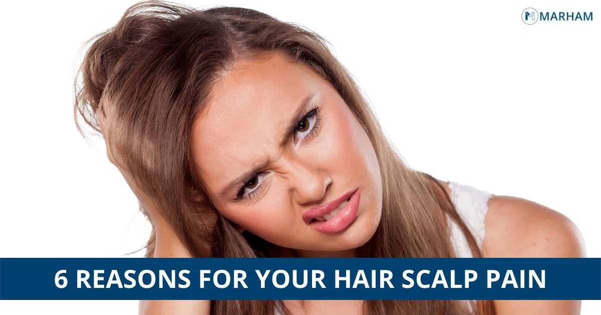 hair-scalp-pain-the-6-weird-reasons-marham