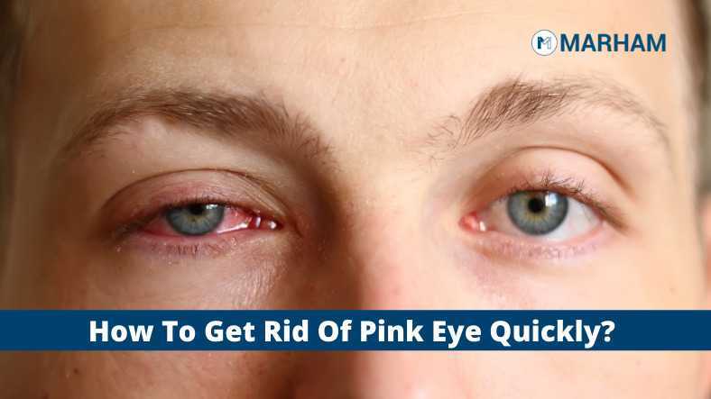 how-to-get-rid-of-pink-eye-quickly-marham