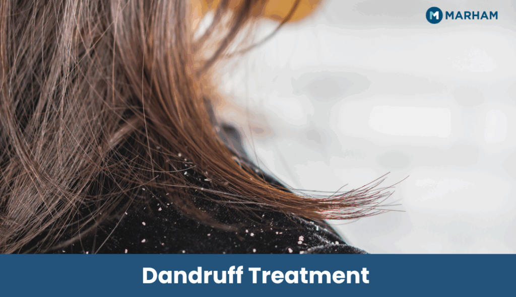 Dandruff Treatment