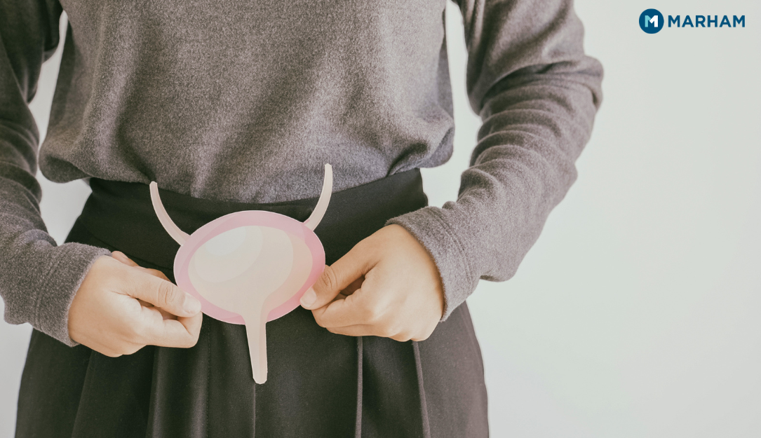 Urinary Incontinence Symptoms