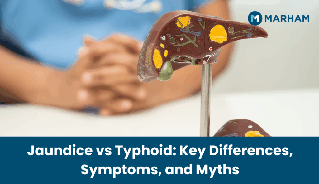 difference between jaundice and typhoid fever