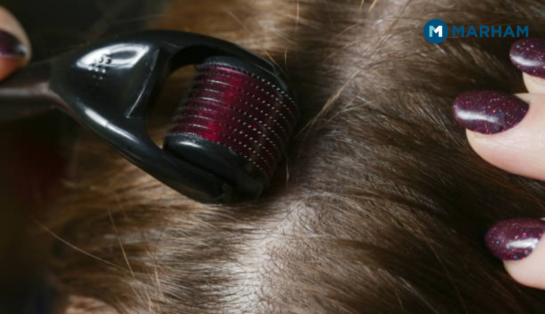 derma roller hair