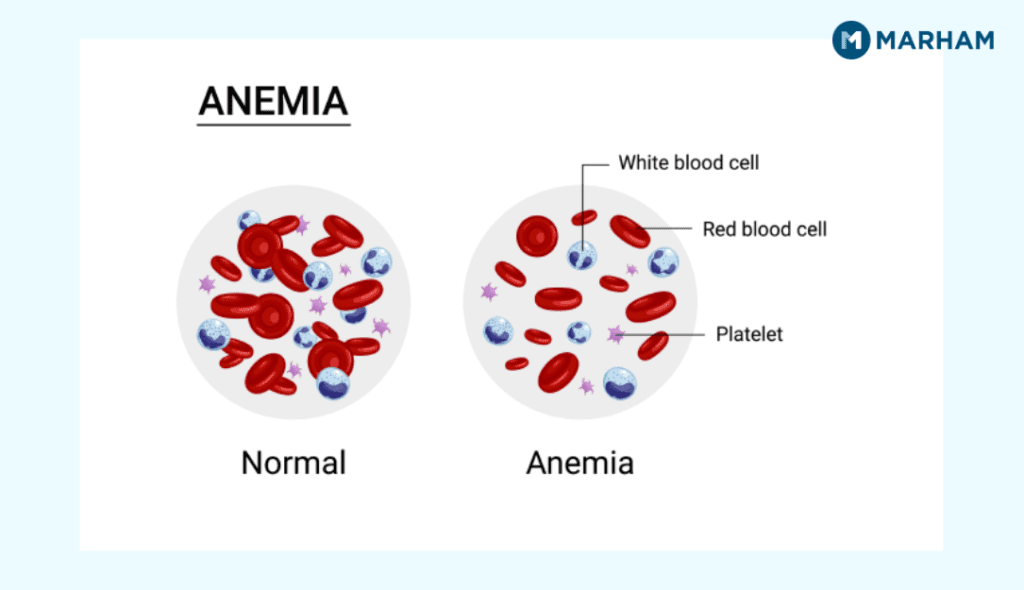 MCH Blood Test: Essential Guide to Normal Range, Low &amp; High Levels