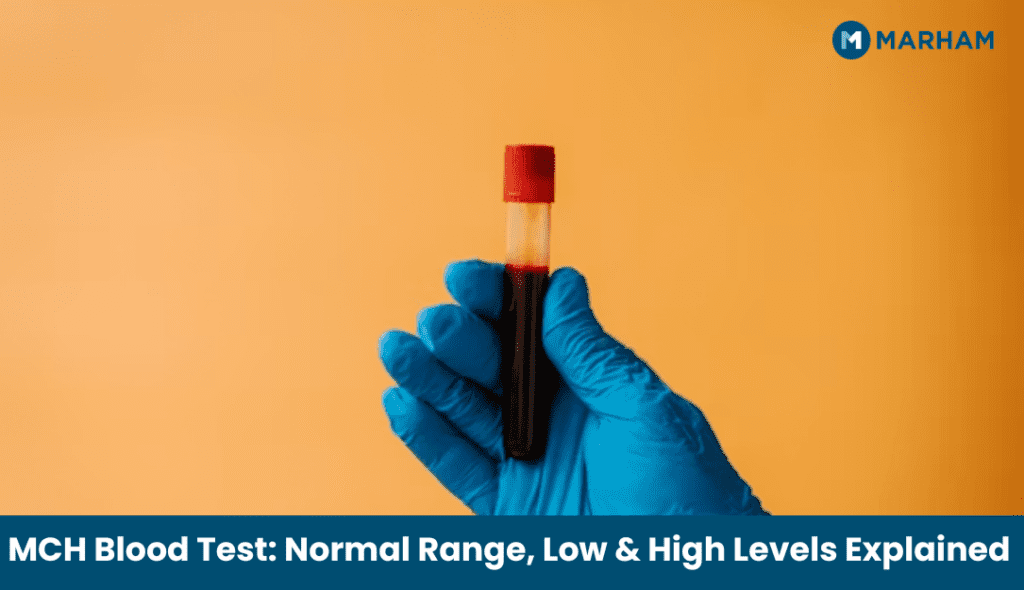MCH Blood Test Normal Range, Low & High Levels Explained