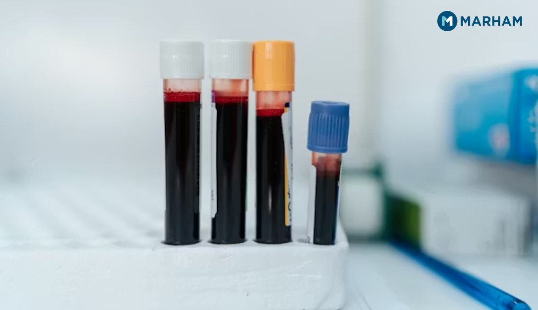 MCH Blood Test Normal Range