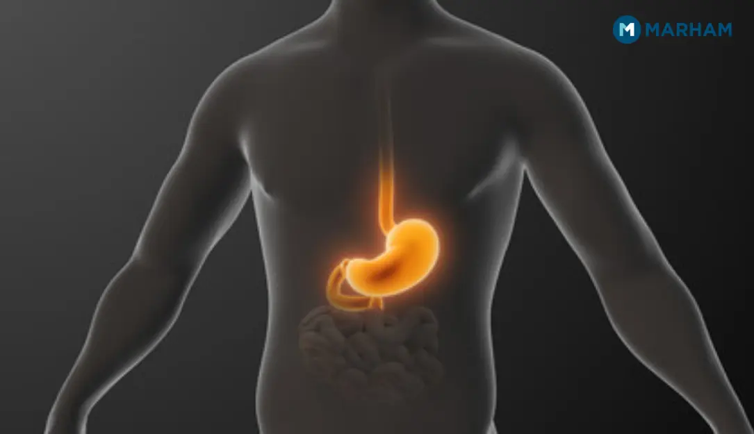 Symptoms of Acidity During Ramadan