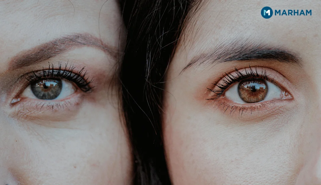 Common Cornea Problems