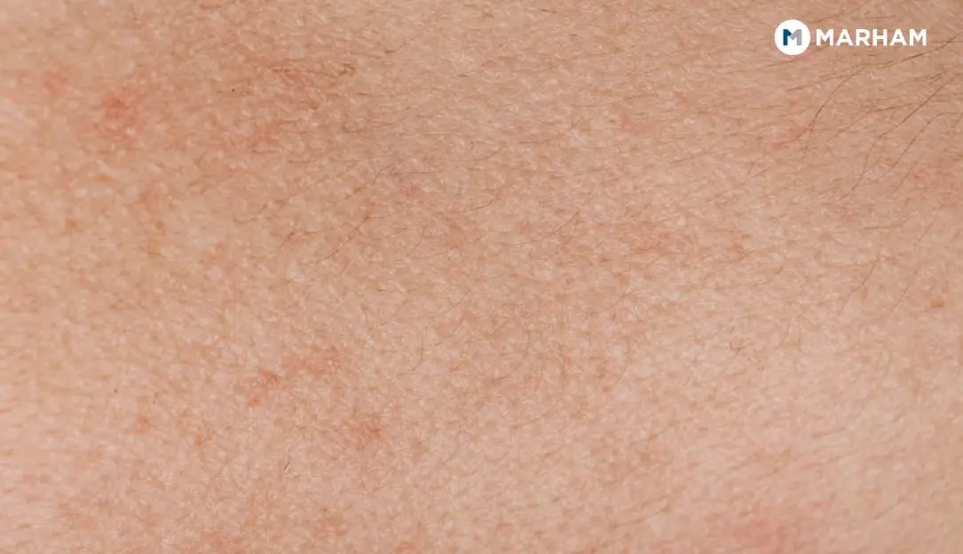 How to Keep Your Largest Organs Healthy