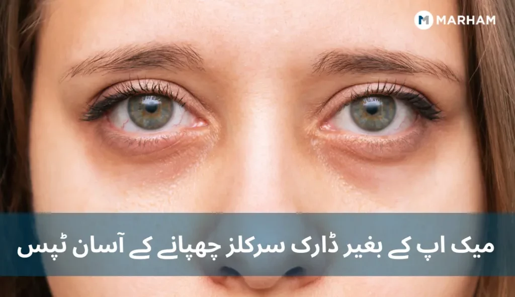 میک اپ کے بغیر ڈارک سرکلز چھپانے کے آسان ٹپس