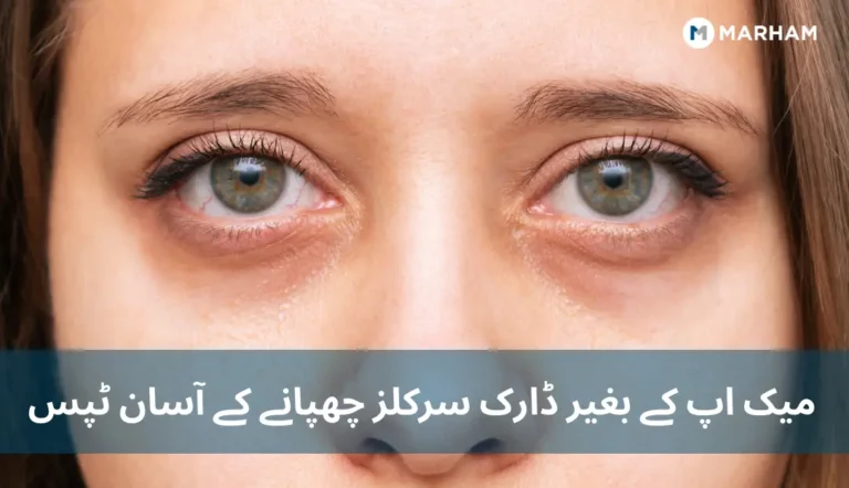 میک اپ کے بغیر ڈارک سرکلز چھپانے کے آسان ٹپس