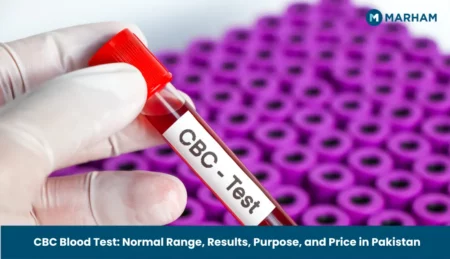 CBC Test Price in Pakistan 2026: Rates, Normal Range and Online Booking CBC Test Price in Pakistan 2026: Rates, Normal Range and Online Booking