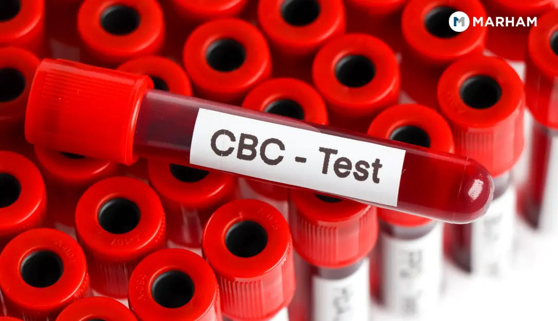 What does a CBC blood test measure: red blood cells, white blood cells, platelets, hemoglobin, and hematocrit explained