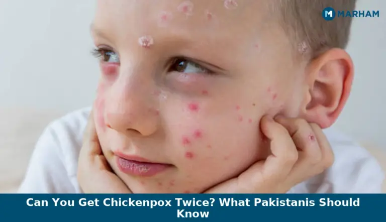Can You Get Chickenpox Twice? What Pakistanis Should Know