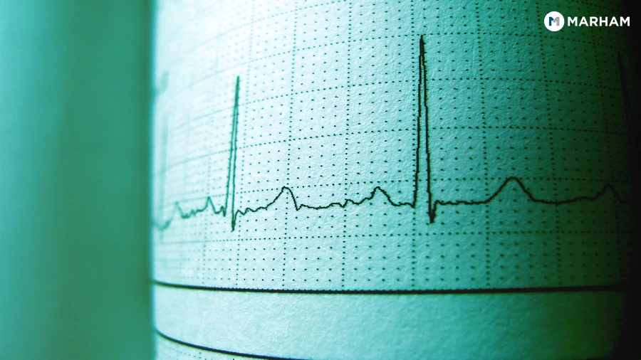 Heart Health Checks: ECG and Blood Pressure Monitoring