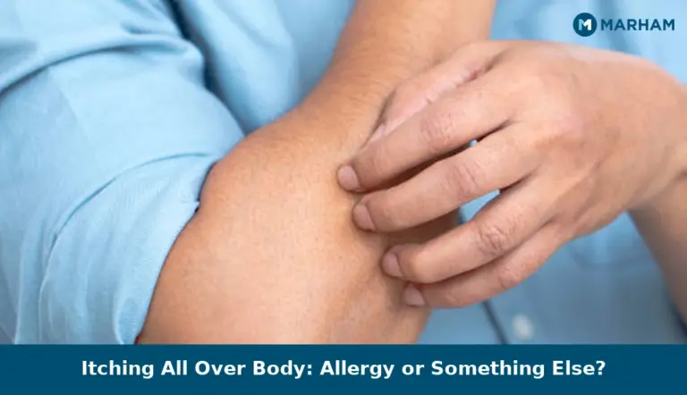 Itching All Over Body: Allergy or Something Else?