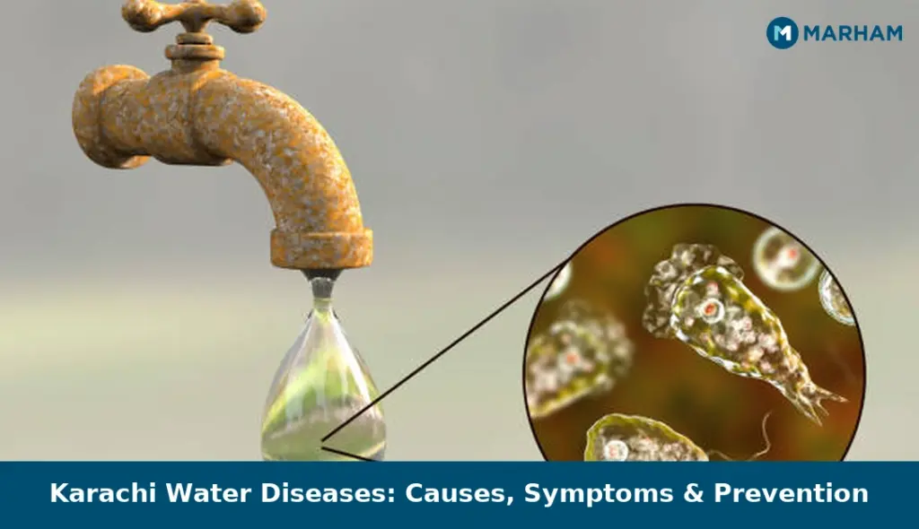 Karachi Water Diseases: Causes, Symptoms & Prevention