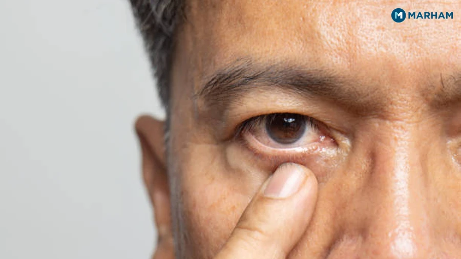 Left Eye Twitching Meaning in Islam: What the Evidence Says