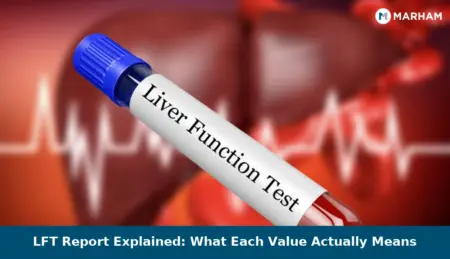 LFT Report Explained: What Each Value Actually Means