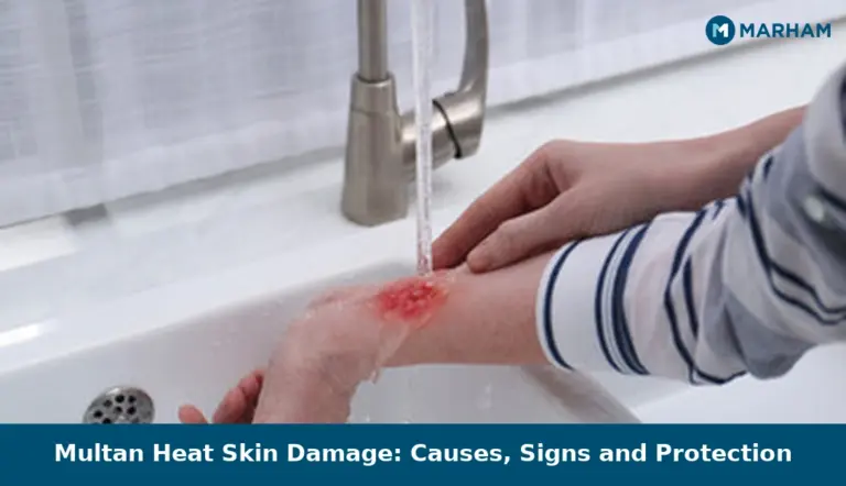 Multan Heat Skin Damage: Causes, Signs and Protection