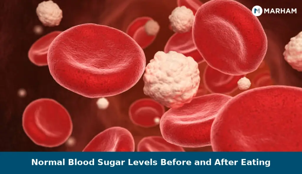 Normal Blood Sugar Levels Before and After Eating
