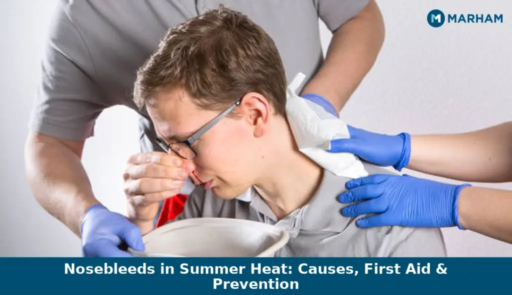 Nosebleeds in Summer Heat: Causes, First Aid & Prevention Nosebleeds in Summer Heat: Causes, First Aid & Prevention
