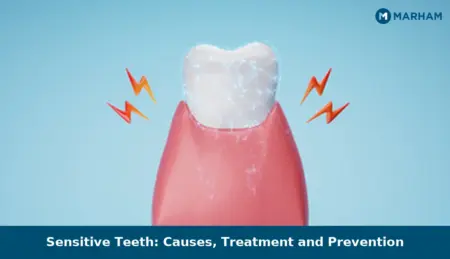Sensitive Teeth: Causes, Treatment and Prevention
