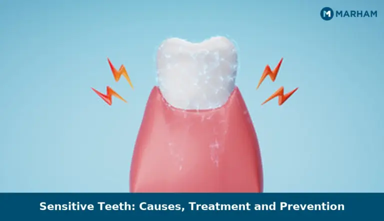 Sensitive Teeth: Causes, Treatment and Prevention