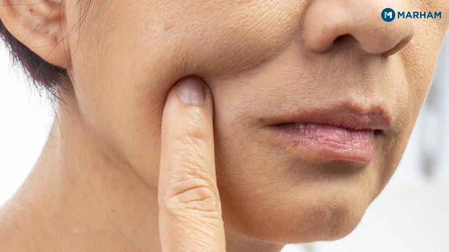 Oily Skin: Signs, Causes, and Care in Pakistan