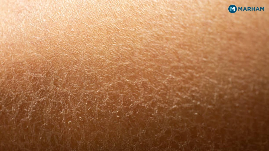 Normal and Sensitive Skin: What They Feel Like