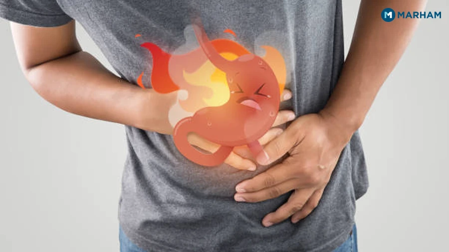 Foods to Avoid When Your Stomach Burns
