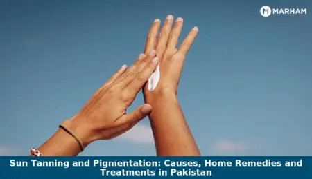 Sun Tanning and Pigmentation: Causes, Home Remedies and Treatments in Pakistan