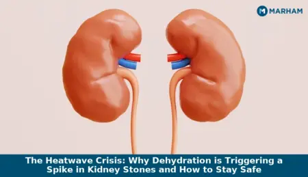 kidney stones in summer