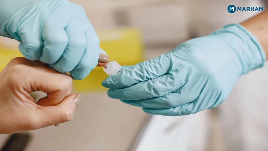 Uric Acid Test in Pakistan: What to Expect