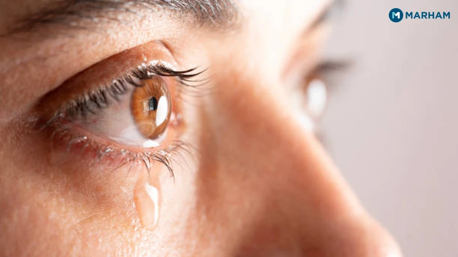 What Causes Watery Eyes?