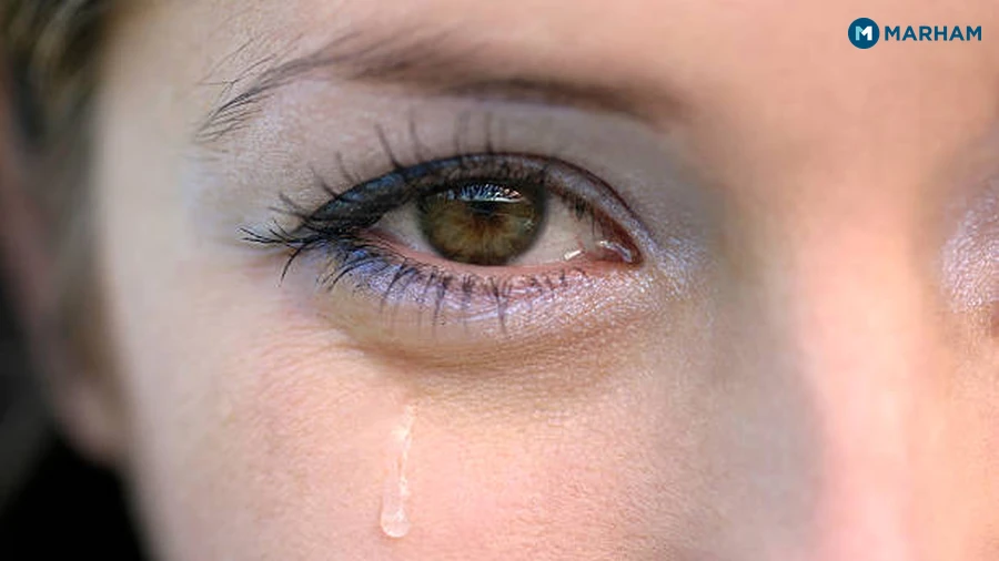 When to See a Doctor for Watery Eyes