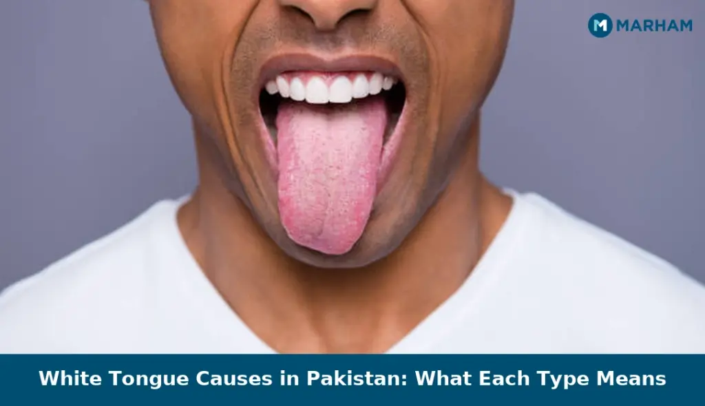 White Tongue Causes in Pakistan: What Each Type Means White Tongue Causes in Pakistan: What Each Type Means