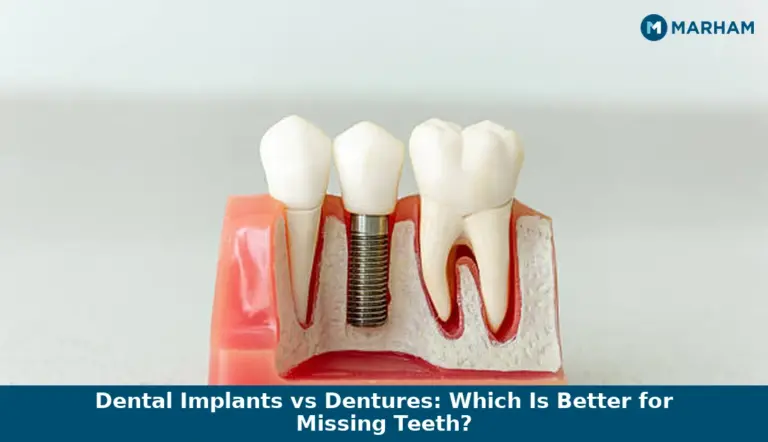 Dental Implants vs Dentures: Which Is Better for Missing Teeth?