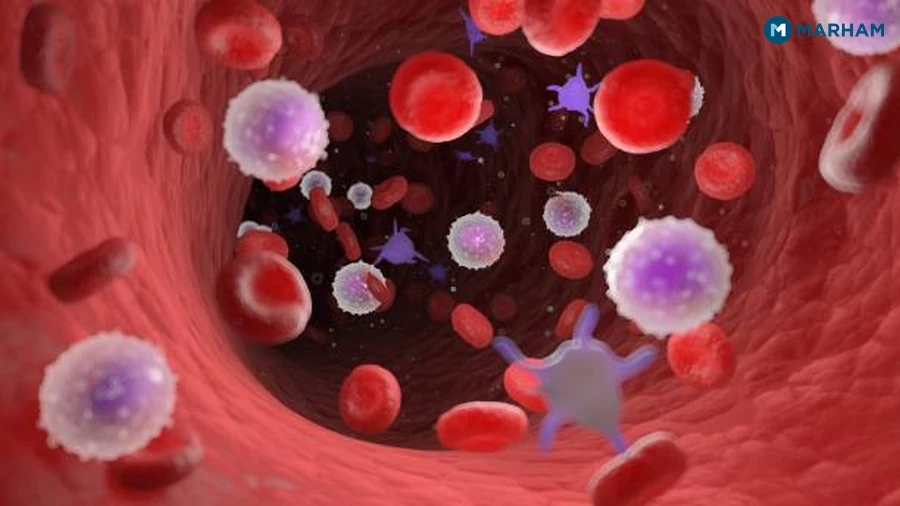 Common Causes of Low Platelet Count in Pakistan
