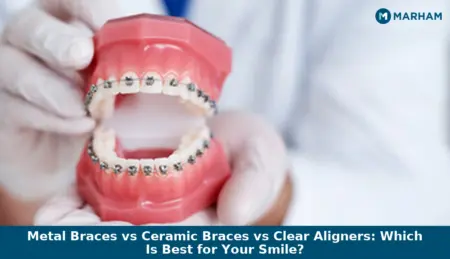 Metal Braces vs Ceramic Braces vs Clear Aligners: Which Is Best for Your Smile? Metal Braces vs Ceramic Braces vs Clear Aligners: Which Is Best for Your Smile?