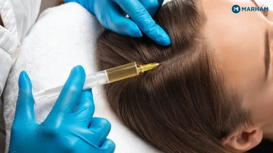What Is a Hair Transplant?