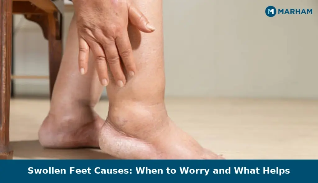 Swollen Feet Causes: When to Worry and What Helps