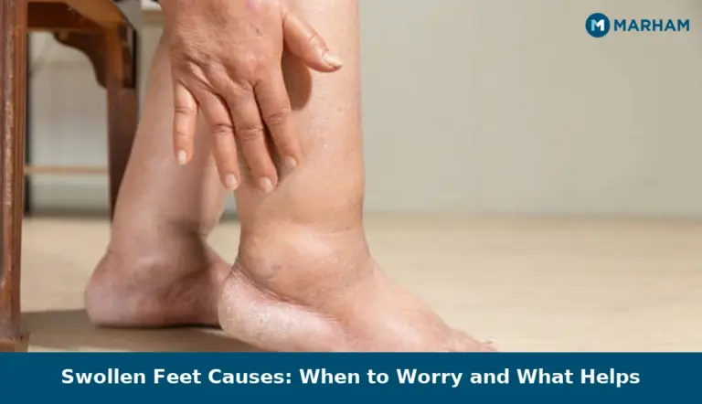 Swollen Feet Causes: When to Worry and What Helps