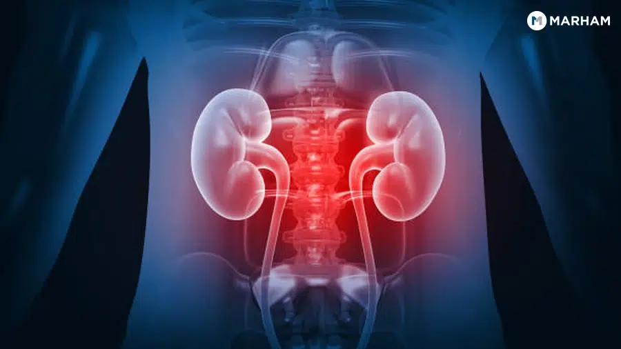 When Should You See a Urologist in Pakistan?