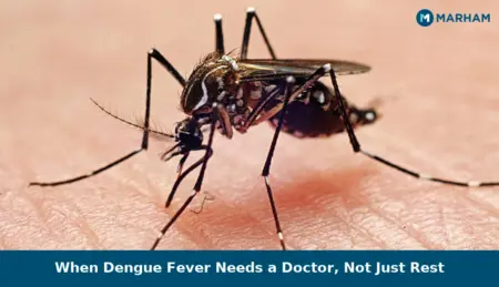 When Dengue Fever Needs a Doctor, Not Just Rest