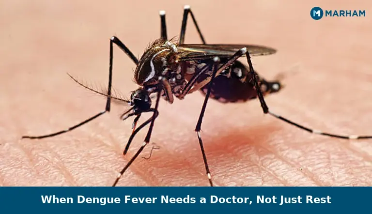 When Dengue Fever Needs a Doctor, Not Just Rest