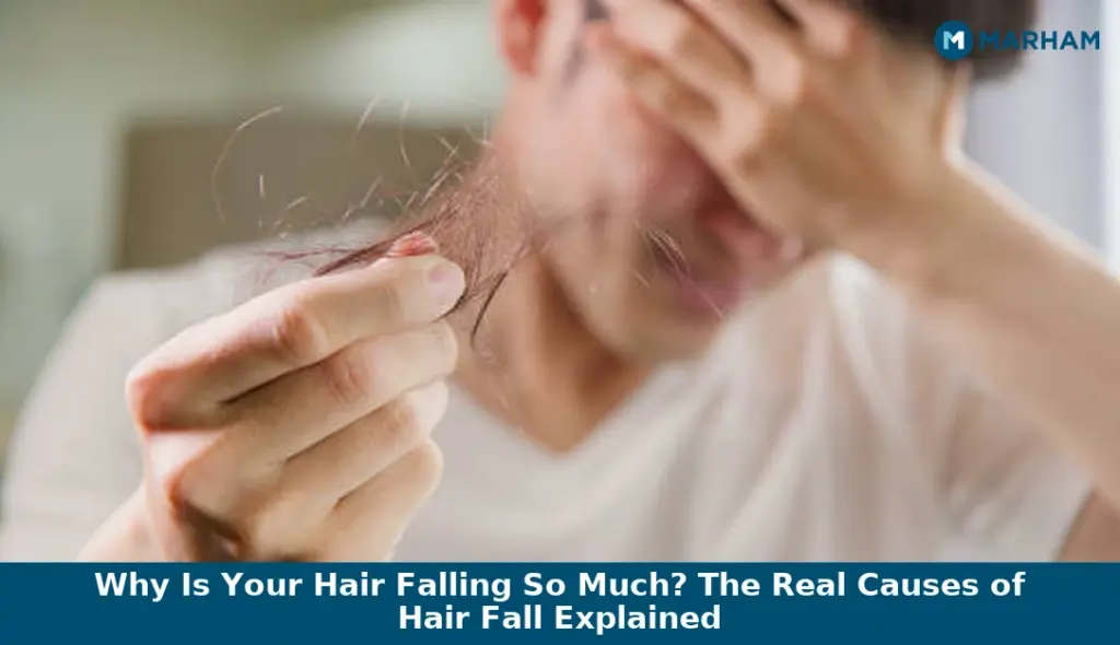 Why Is Your Hair Falling So Much? The Real Causes of Hair Fall Explained Why Is Your Hair Falling So Much? The Real Causes of Hair Fall Explained