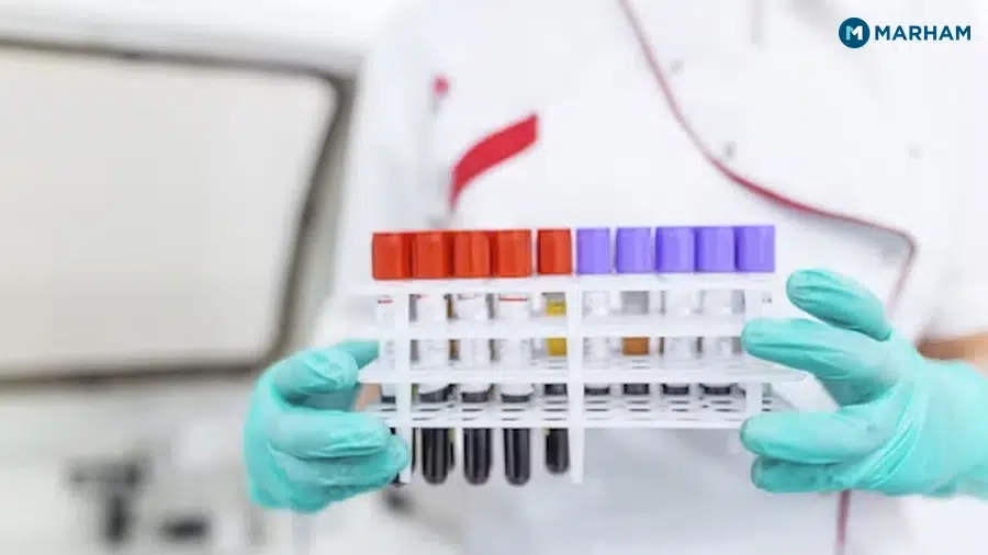 Early Detection: The Biggest Reason Lab Tests Matter