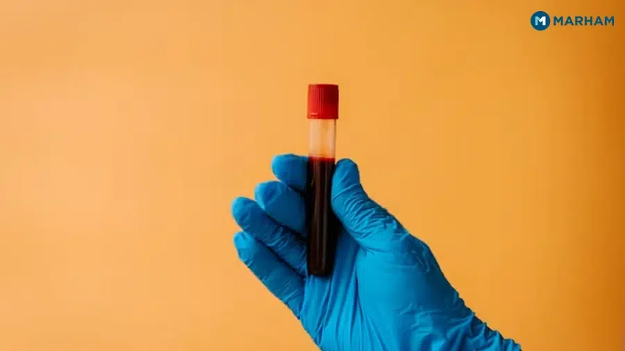 How Often Should You Get Lab Tests in Pakistan?